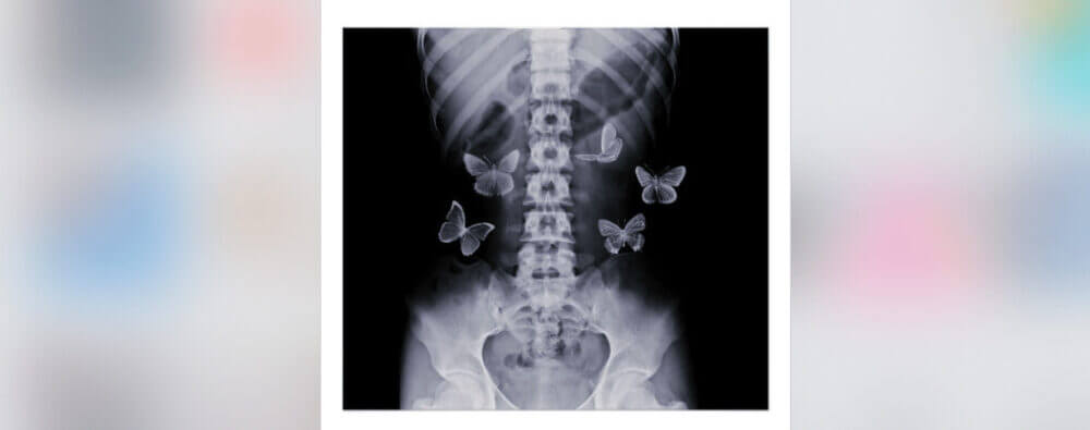 Butterflies in the stomach