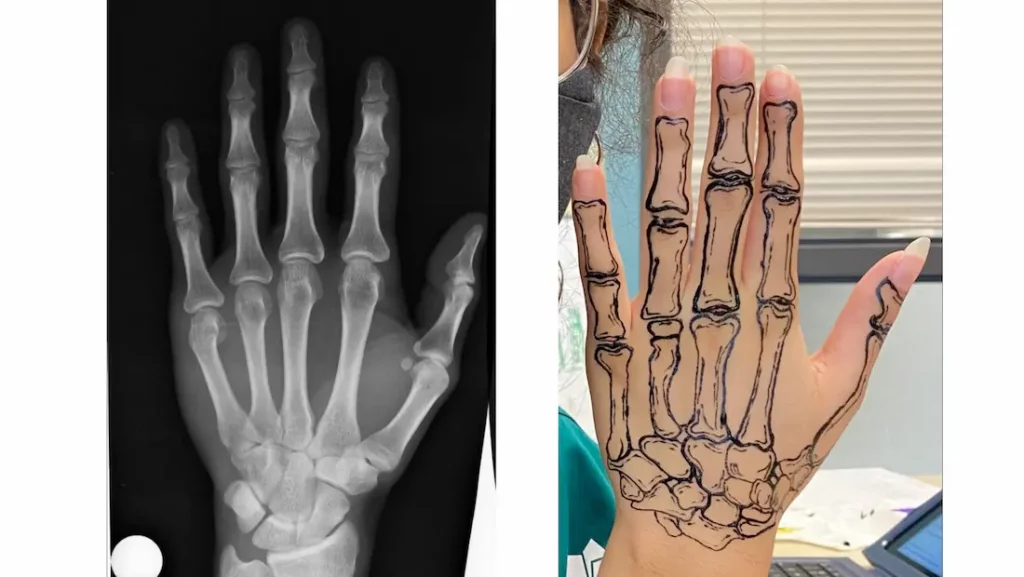 Hand bone x-ray and tattoo illustration as reference pictures